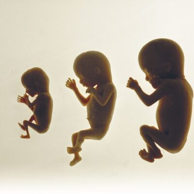 Die Entwicklung vom Embryo zum Baby.